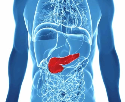 Lý do gì khiến bạn bị ung thư tụy